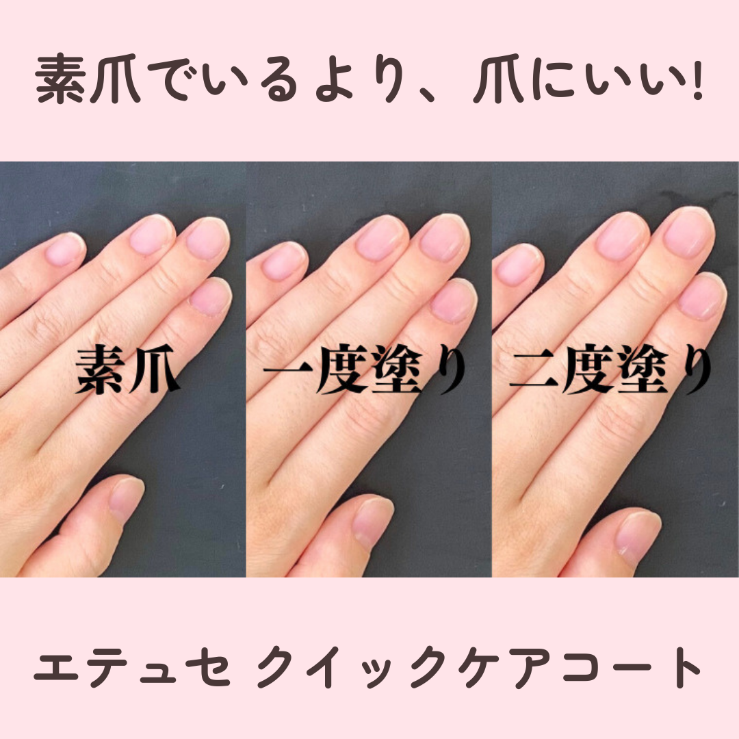 エテュセ クイックケアコート/ettusais/ネイルオイル・トリートメントを使ったクチコミ（1枚目）