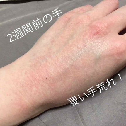 ナノアミノ ハンド&ネイルリペアクリーム/ナノアミノ/ハンドクリームを使ったクチコミ(2枚目)