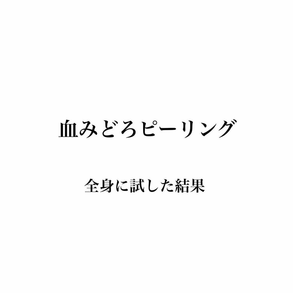 AHA 30% + BHA 2% Peeling Solution/The Ordinary/ピーリングを使ったクチコミ(1枚目)