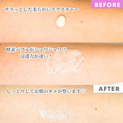 Abo on LIPS 「やっほーAboです🤍✨❤ペプチドボリュームリフティングプロエッ..」(4枚目)