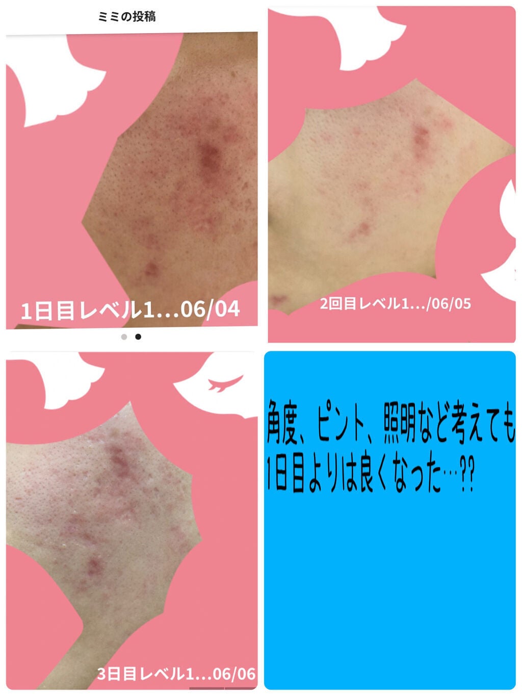 もち肌コラーゲンセラム3.0/MEDICUBE/美容液を使ったクチコミ(3枚目)