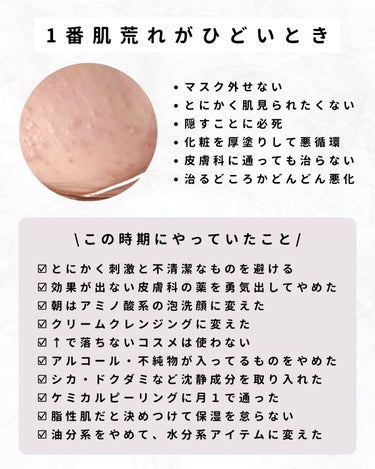 なーこ🫧ニキビ・肌荒れを美肌に on LIPS 「私は肌荒れ治すまでに皮膚科・スキンケア・コスメ・美容施術…10..」（3枚目）