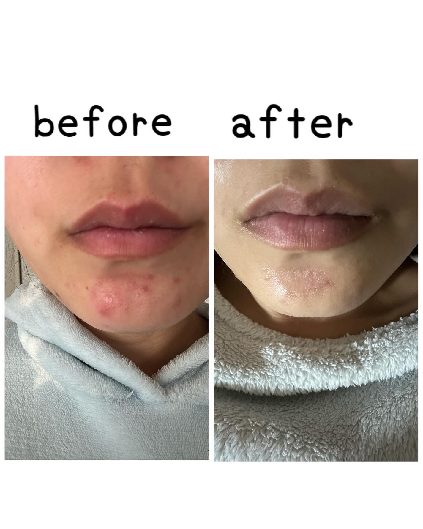 ポテンツェル ポアバランシングAZセラム/POTENZel/美容液を使ったクチコミ(2枚目)