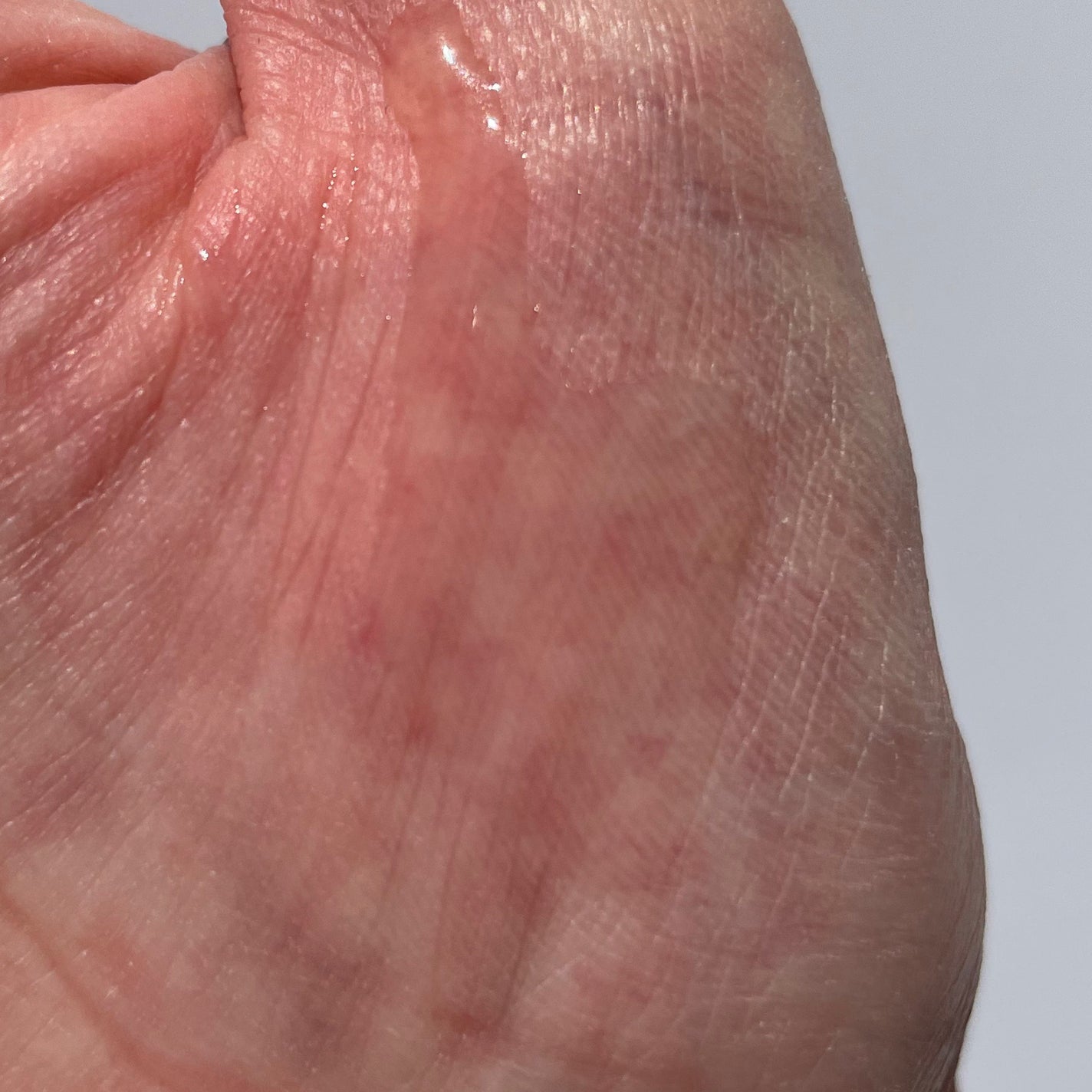 コンプリート オイル/アルファピニ28/その他スキンケアを使ったクチコミ(2枚目)