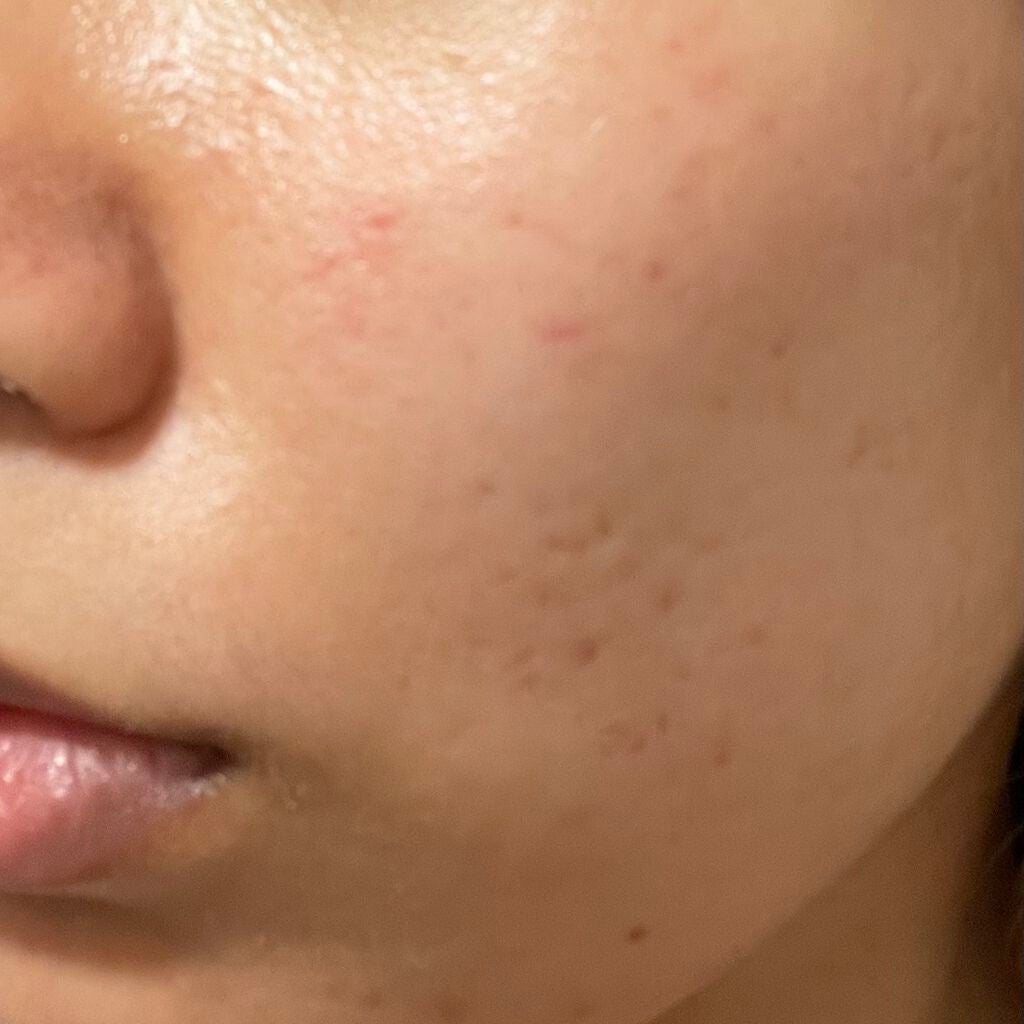 ヘルプミー! ダクトパッド/One-day's you/トナーパッドを使ったクチコミ(10枚目)