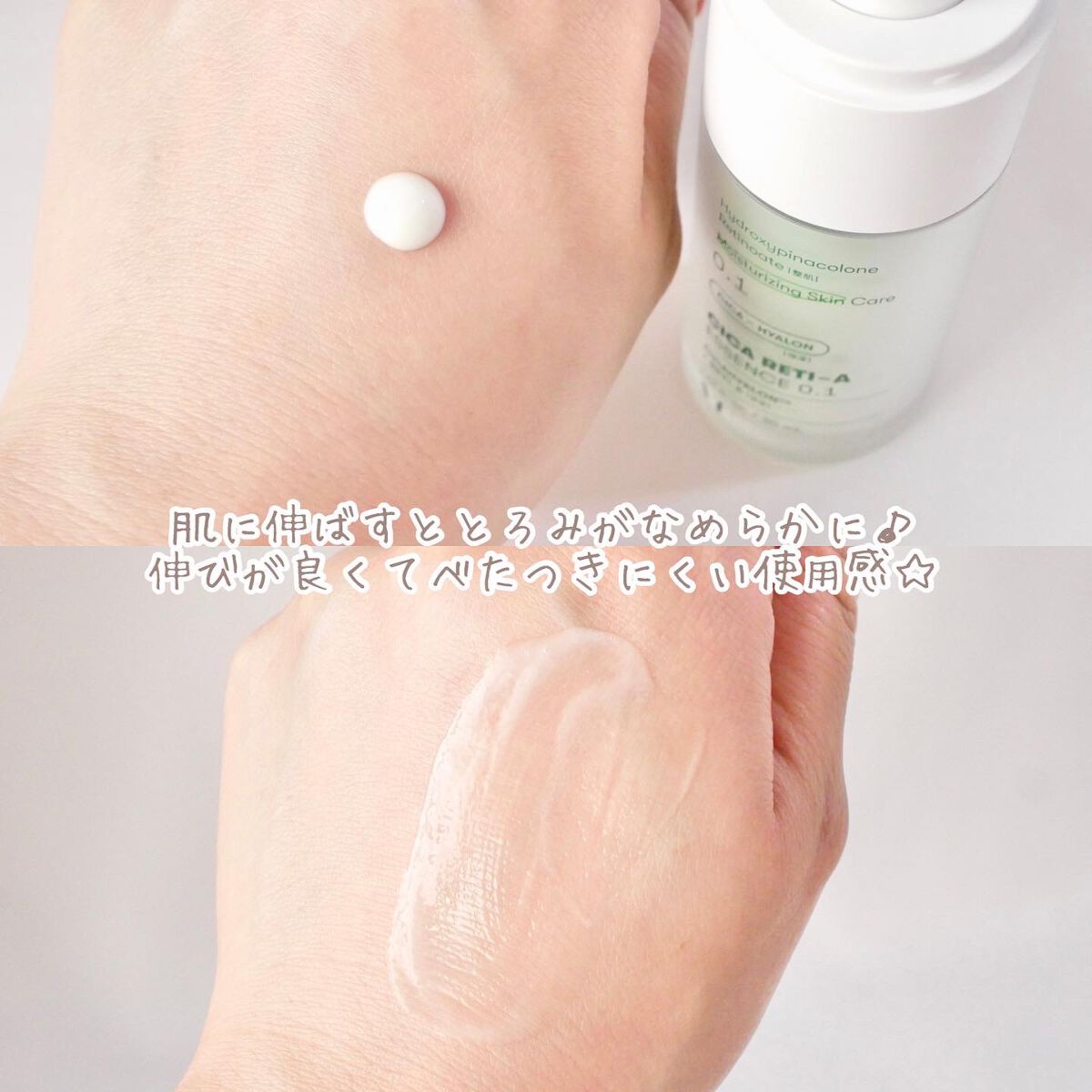 シカレチA エッセンス0.1/VT/美容液を使ったクチコミ(3枚目)