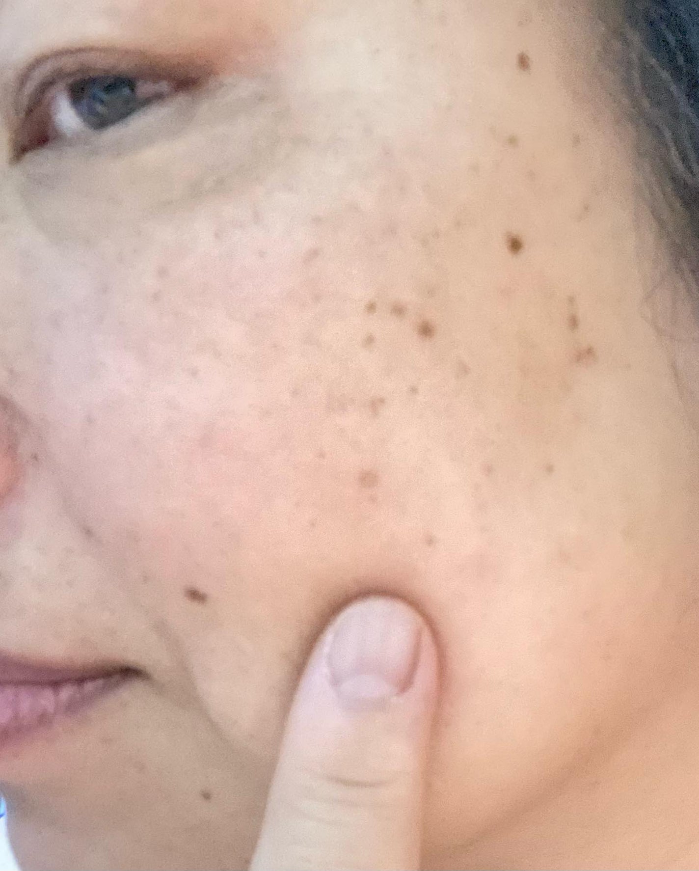 スパークリングセラムパック【YELLOW】/AKAHA/シートマスク・パックを使ったクチコミ(6枚目)