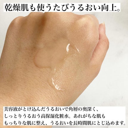 モイスチュア ローション/カルテHD/化粧水を使ったクチコミ(2枚目)