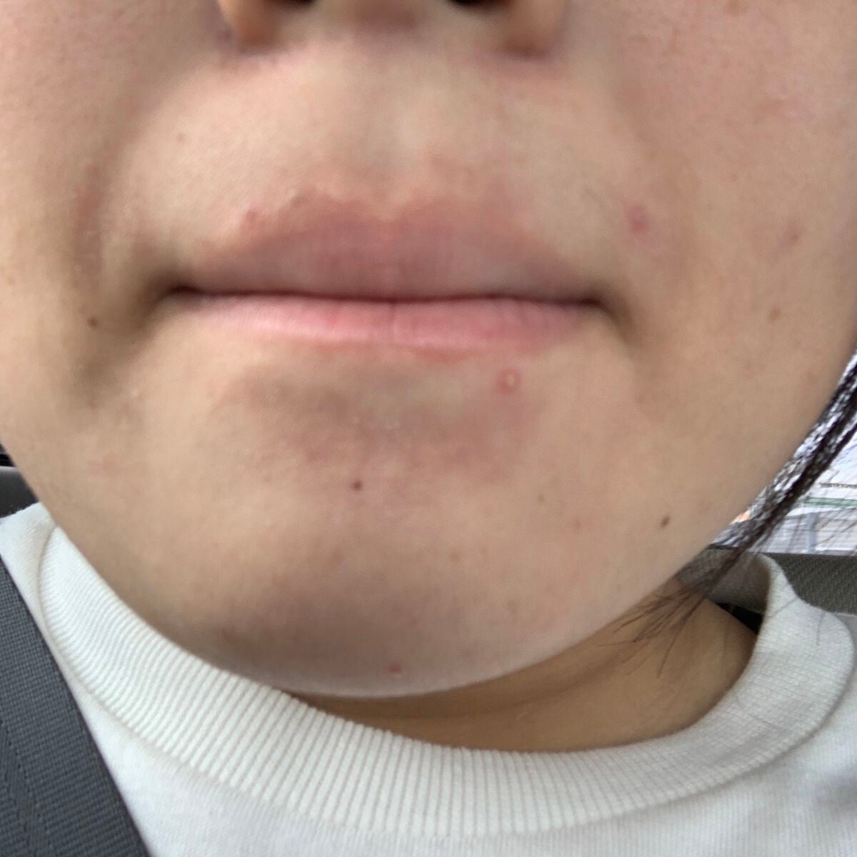 shiny_lips_2mo on LIPS 「⚠️お見苦しい写真失礼🙇♀️🙇♀️最近仕事の疲れでなのか、..」(2枚目)