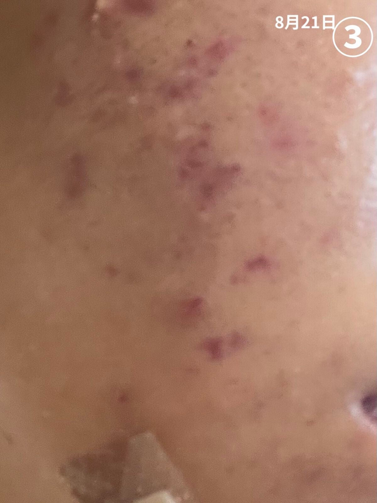 薬用しみ対策 美白化粧水/メラノCC/化粧水を使ったクチコミ(4枚目)