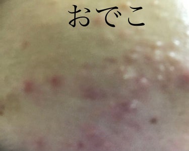 化粧水　敏感肌用　さっぱりタイプ/無印良品/化粧水を使ったクチコミ（2枚目）