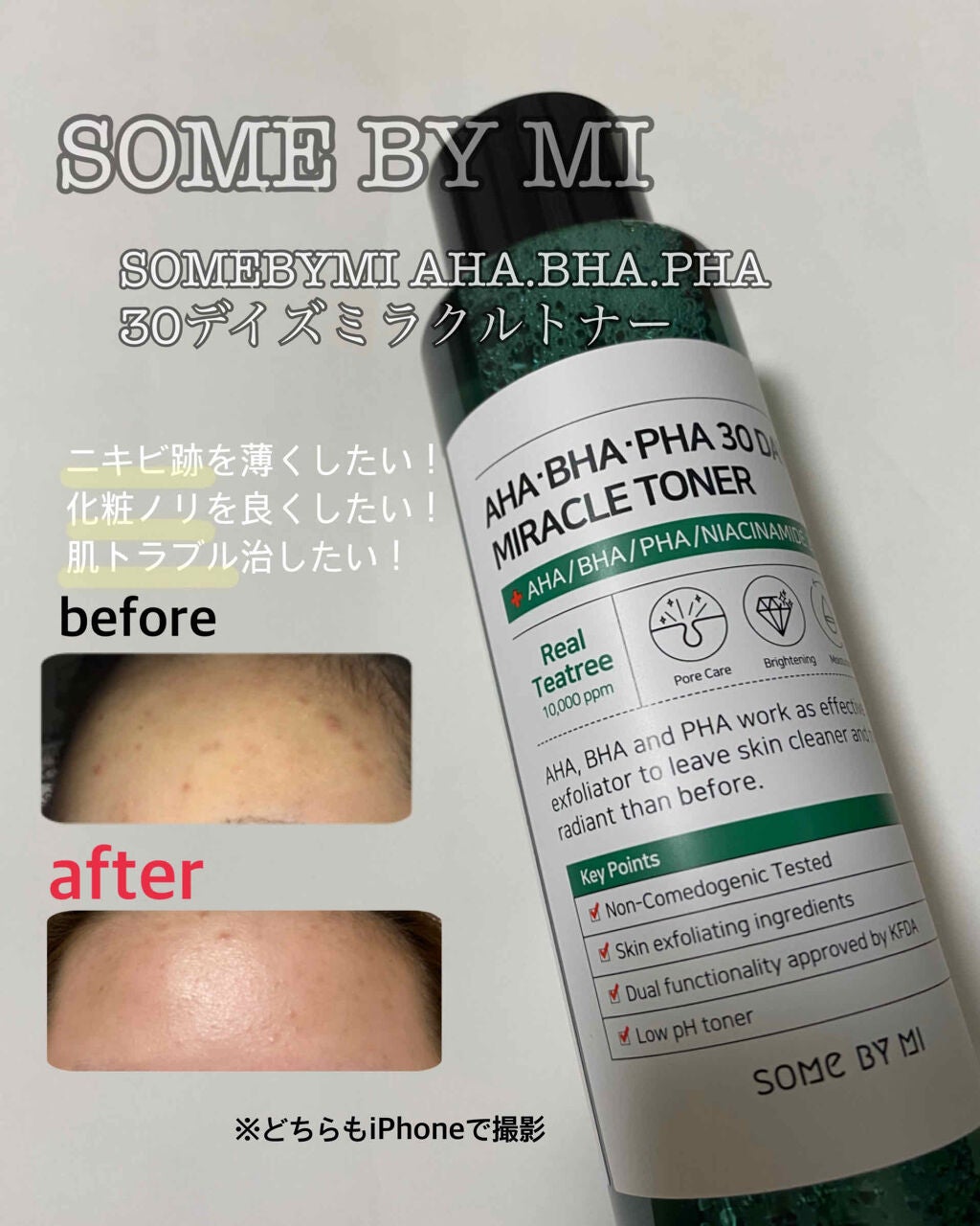 AHA·BHA·PHA 30デイズミラクルトナー/SOME BY MI/化粧水を使ったクチコミ(1枚目)