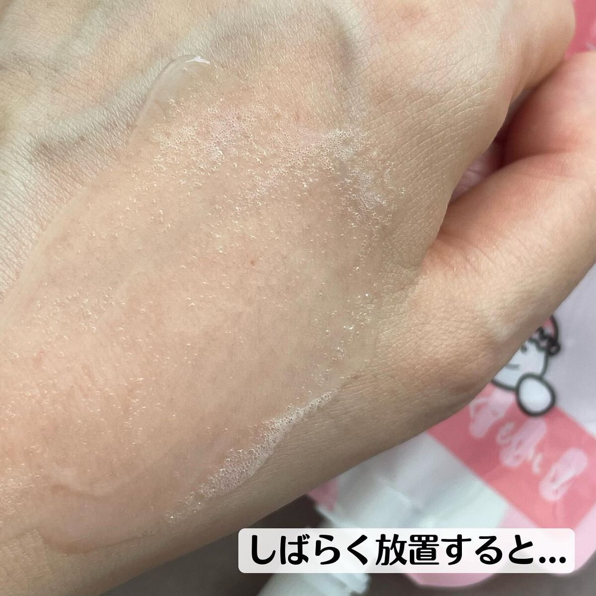 マジックバブルエッセンスパックMINI/BAKER7/シートマスク・パックを使ったクチコミ(4枚目)