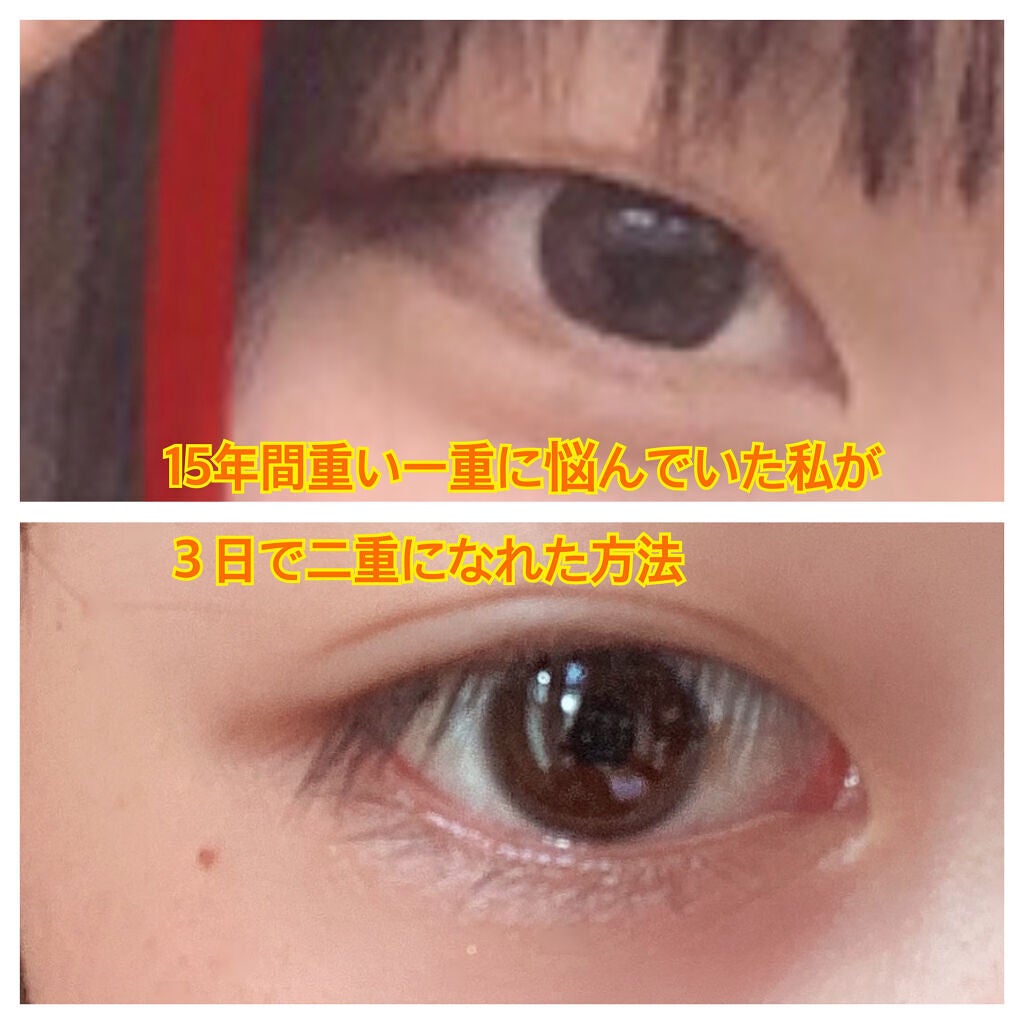 のびーるアイテープ(絆創膏タイプ、レギュラー)/DAISO/二重まぶた用アイテムを使ったクチコミ(1枚目)