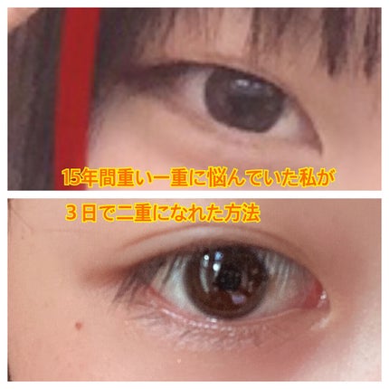 アイテープ(絆創膏タイプ、レギュラー、70枚)/DAISO/二重まぶた用アイテムを使ったクチコミ(1枚目)