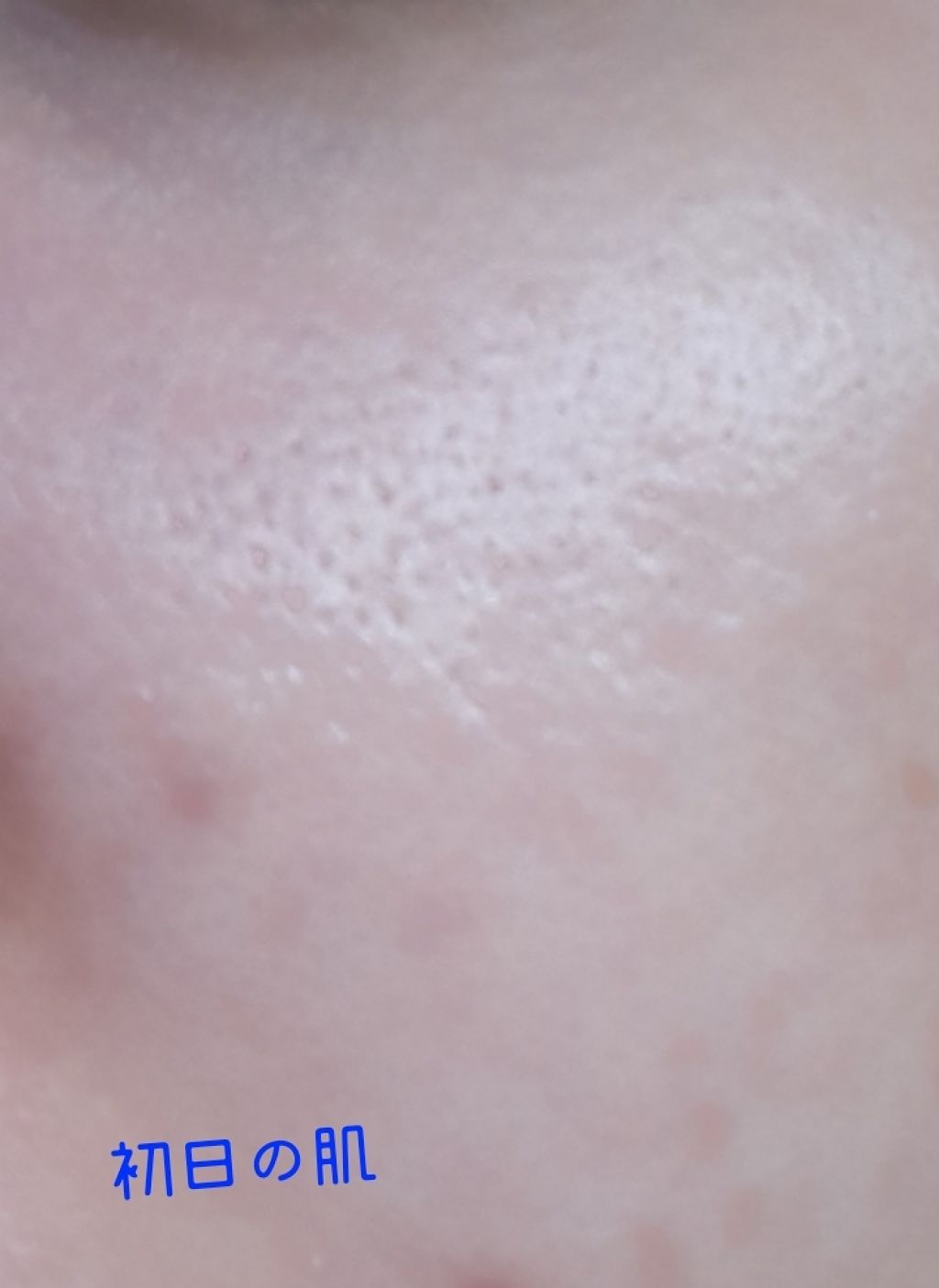 ローション II/BENEFIQUE/化粧水を使ったクチコミ（2枚目）