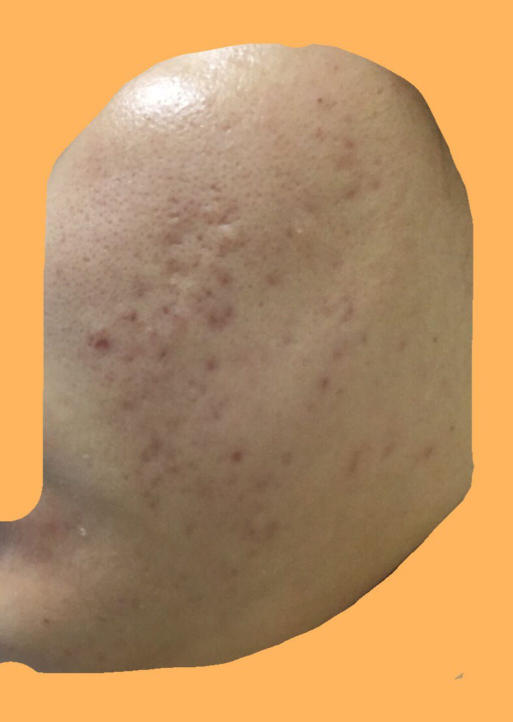 薬用しみ対策 美白化粧水/メラノCC/化粧水を使ったクチコミ（2枚目）