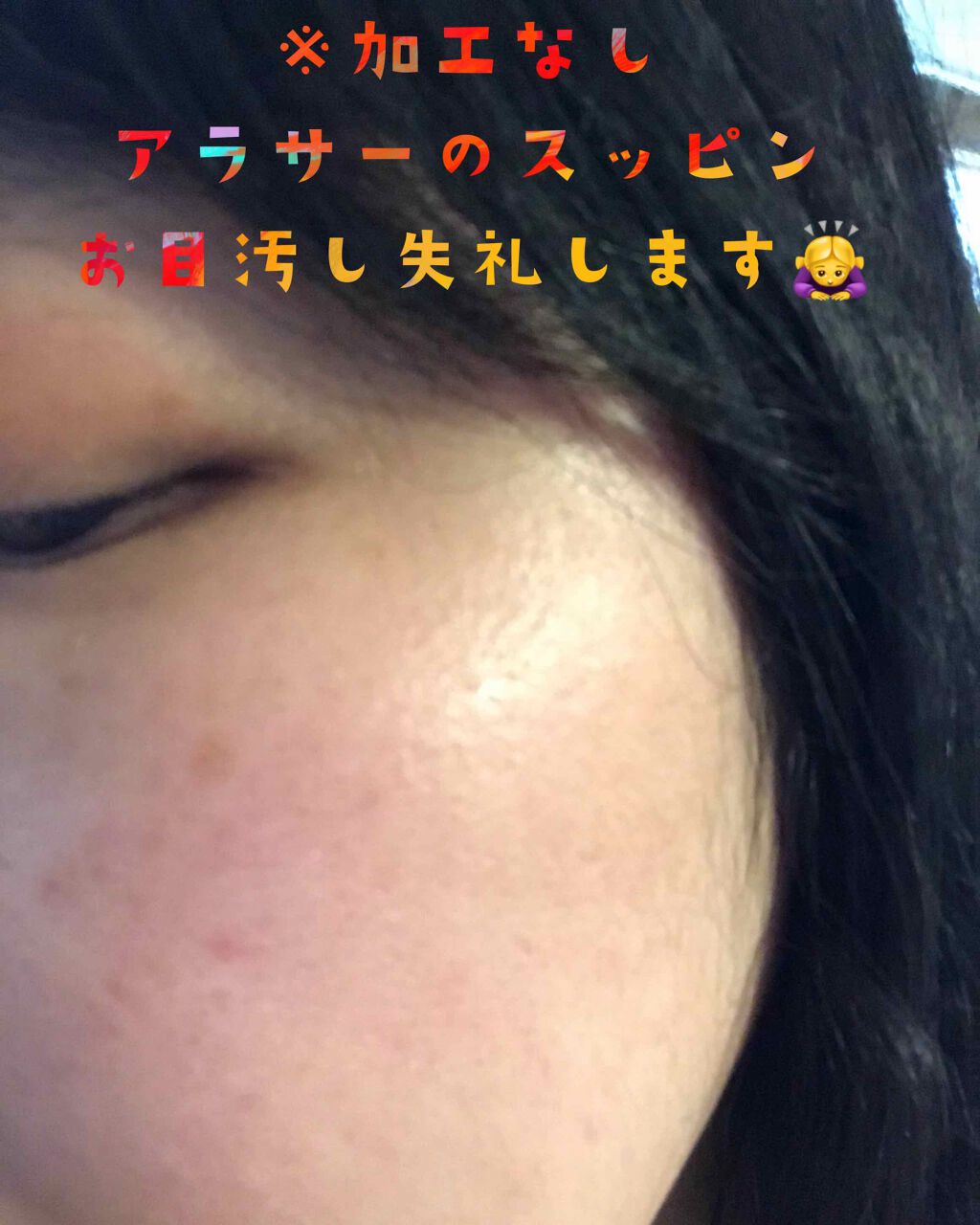 ベイビッシュ 朝ケアマスク/クリアターン/シートマスク・パックを使ったクチコミ(2枚目)