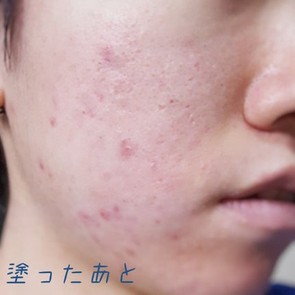 フィニッシングパウダー パールラメ入り/チャコット・コスメティクス/ルースパウダーを使ったクチコミ(5枚目)