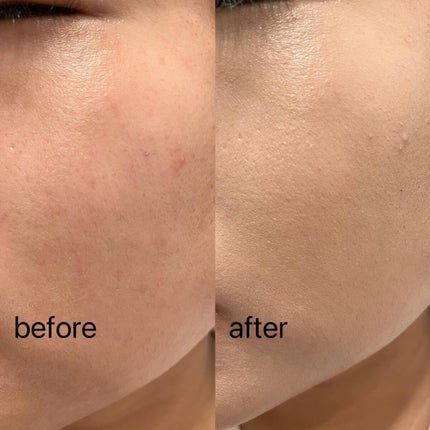 デューイーグロー フィッティング クッション/HASH/クッションファンデーションを使ったクチコミ(5枚目)