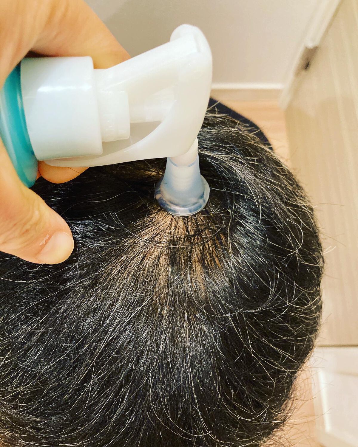 スペシャルケアセット(スキャルプパッチ/育毛トニック)/fasa/頭皮ローションを使ったクチコミ（2枚目）