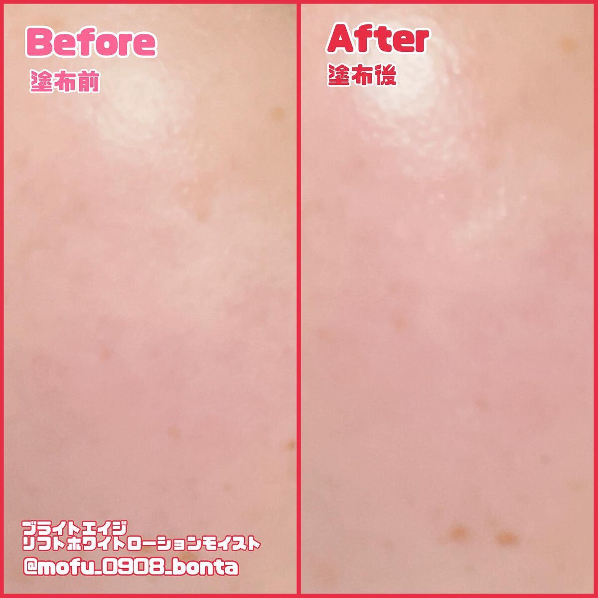 リフトホワイト パーフェクション/BRIGHTAGE/美容液を使ったクチコミ（3枚目）