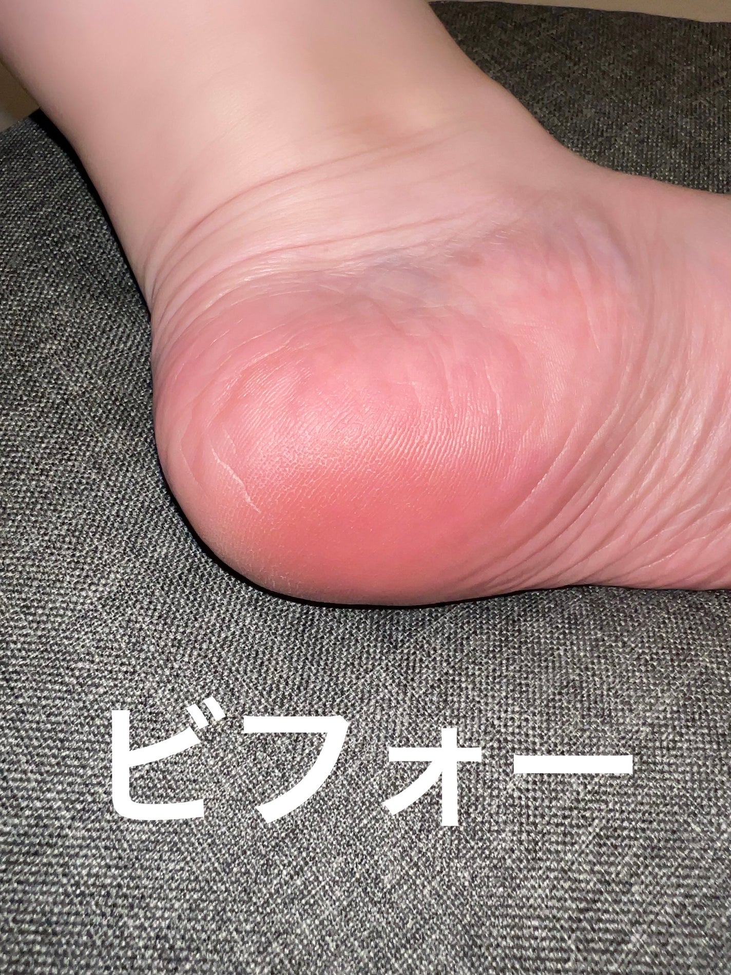 イージーパックDP60分タイプ/ベビーフット/レッグ・フットケアを使ったクチコミ(4枚目)