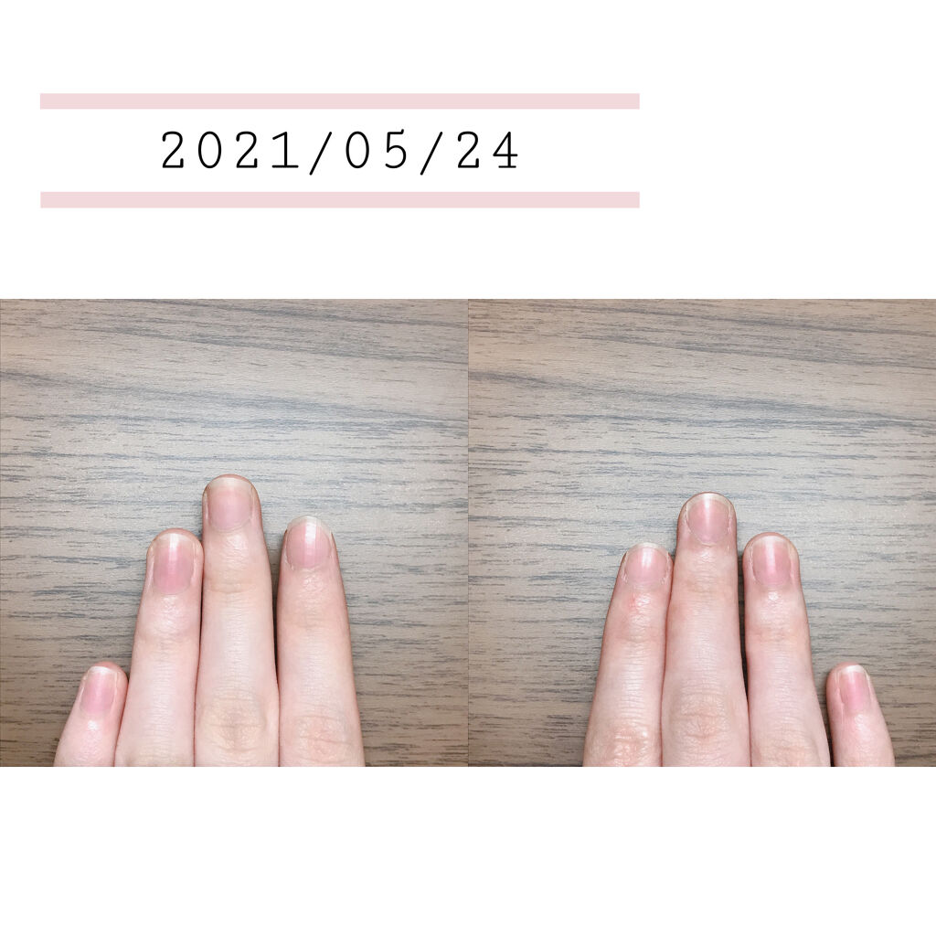 キューティクルオイル/ネイルホリック/ネイルオイル・トリートメントを使ったクチコミ（2枚目）