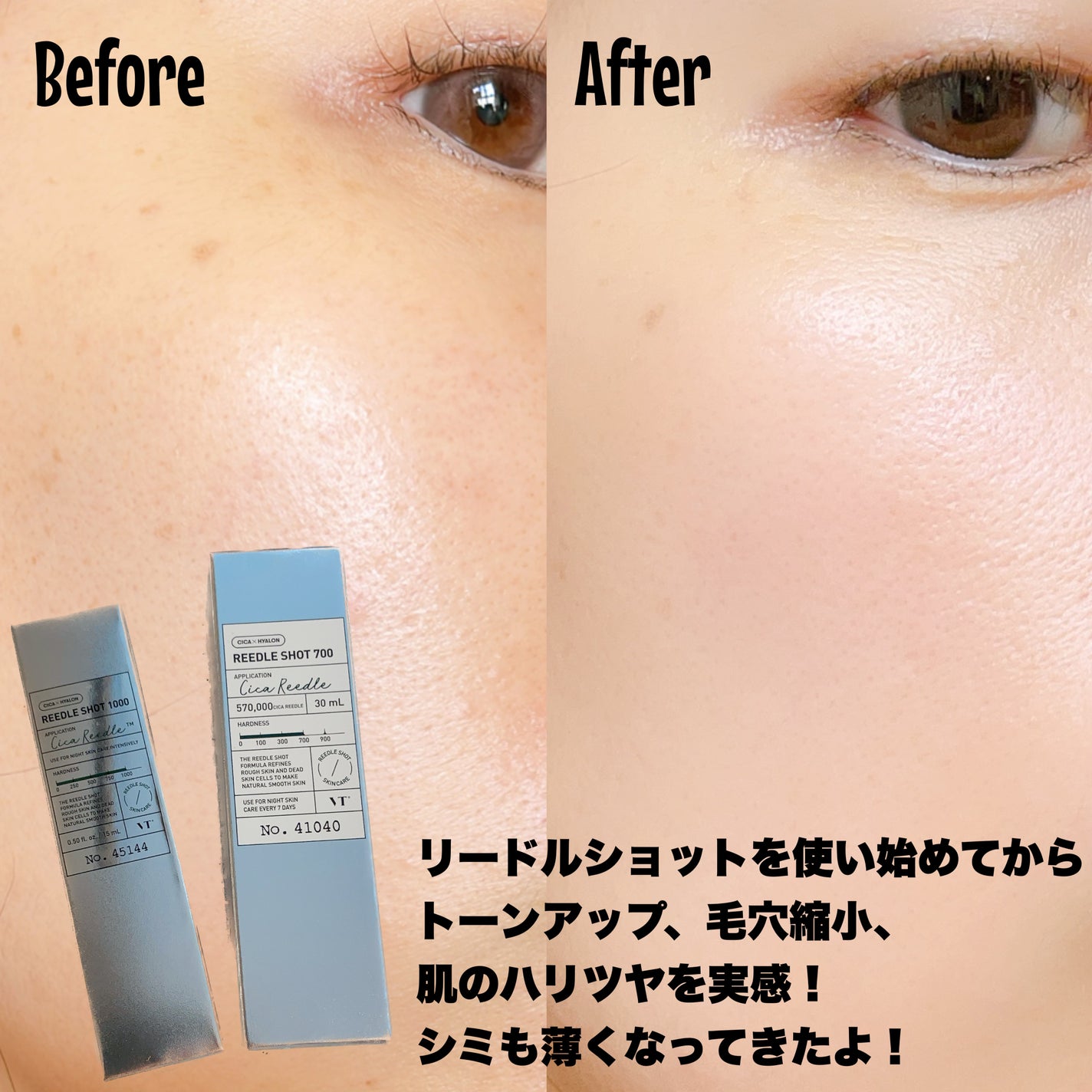 リードルショット700/VT/美容液を使ったクチコミ(6枚目)