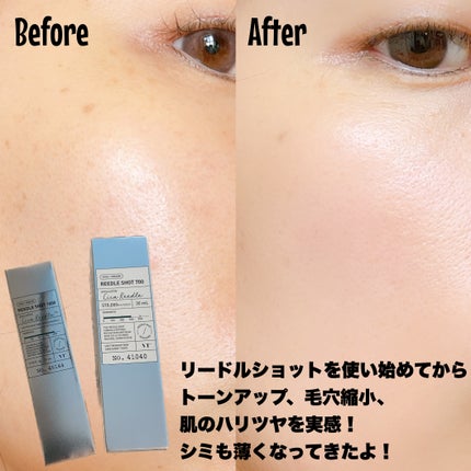リードルショット700/VT/美容液を使ったクチコミ(6枚目)