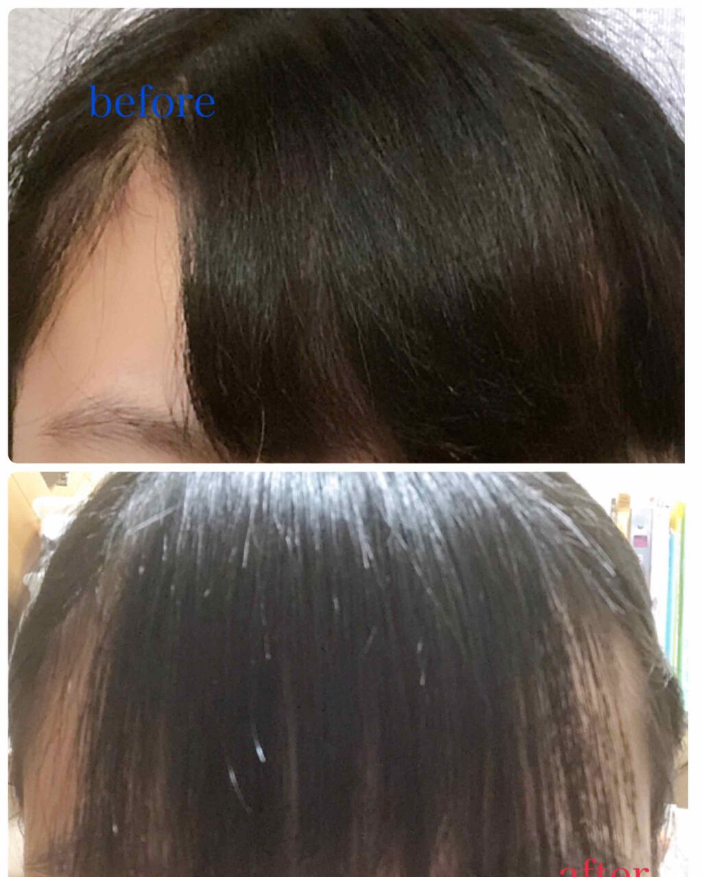 ヘアーカッター/DAISO/ヘアケアグッズを使ったクチコミ(1枚目)