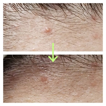 マジックティーツリーオイル/ブラン/フェイスオイルを使ったクチコミ(4枚目)