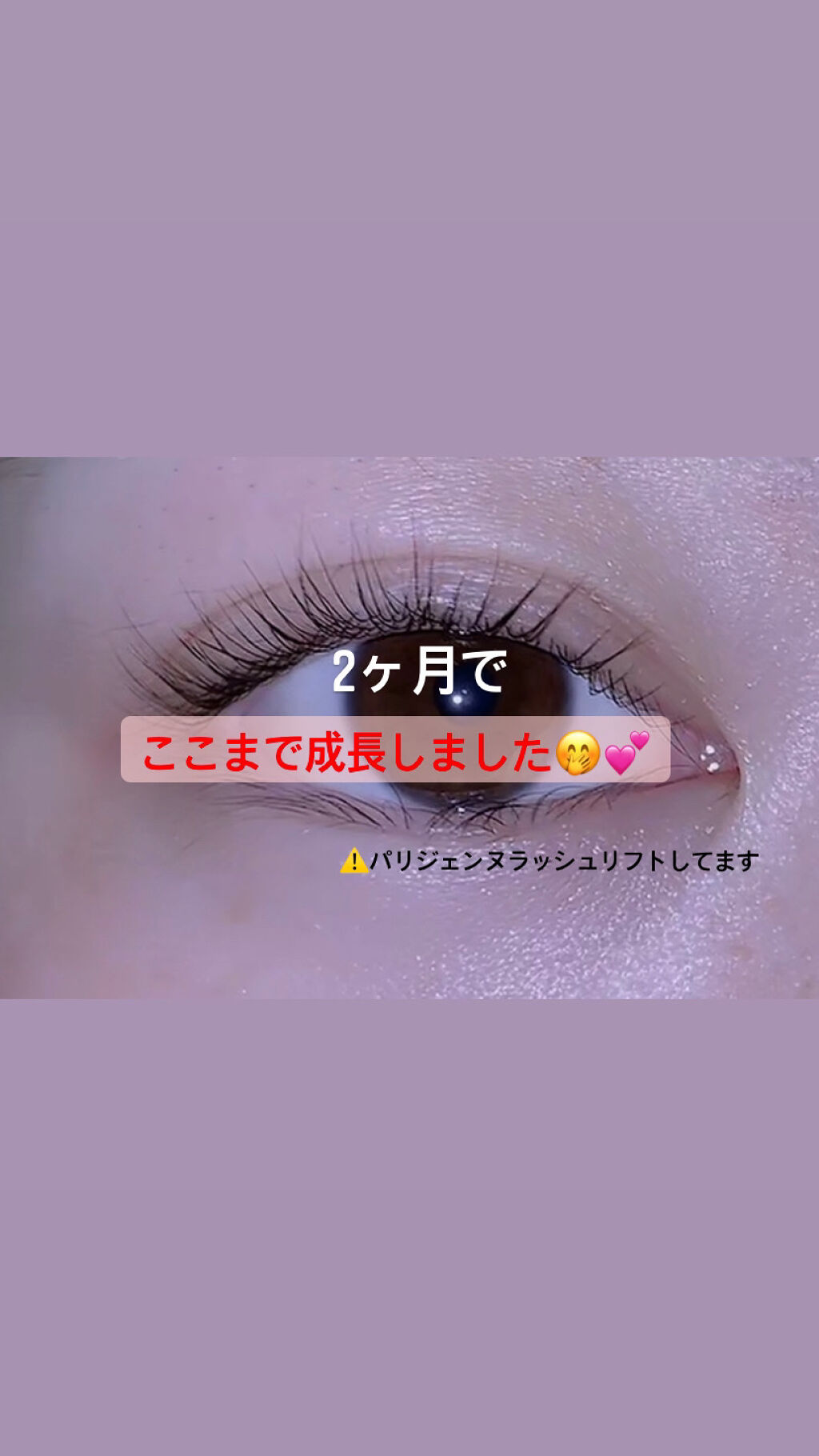 EGUTAM エグータム/アルマダスタイル/まつげ美容液を使ったクチコミ（3枚目）