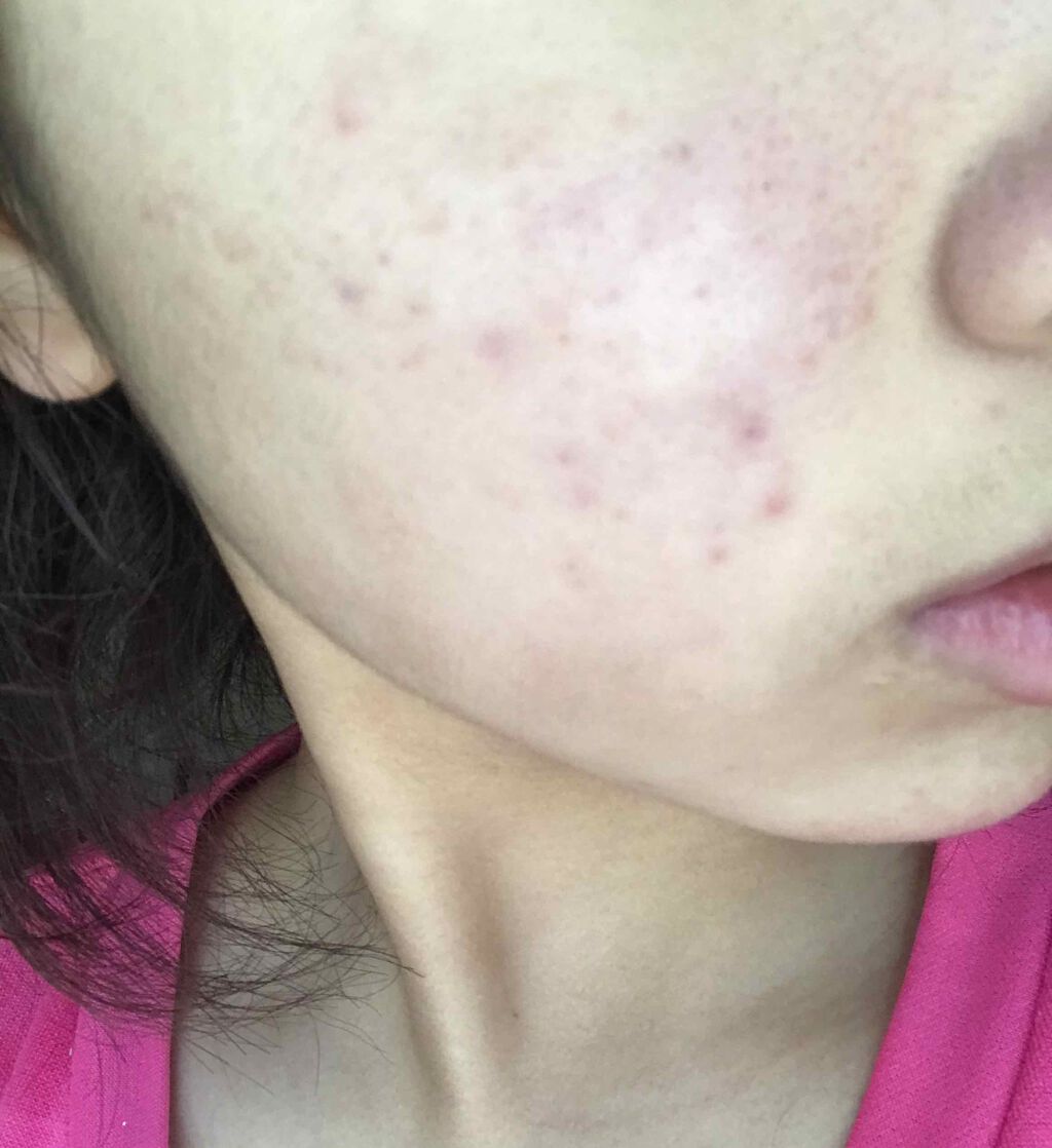 スキンケア洗顔料 オイルコントロール/ビオレ/洗顔フォームを使ったクチコミ（3枚目）