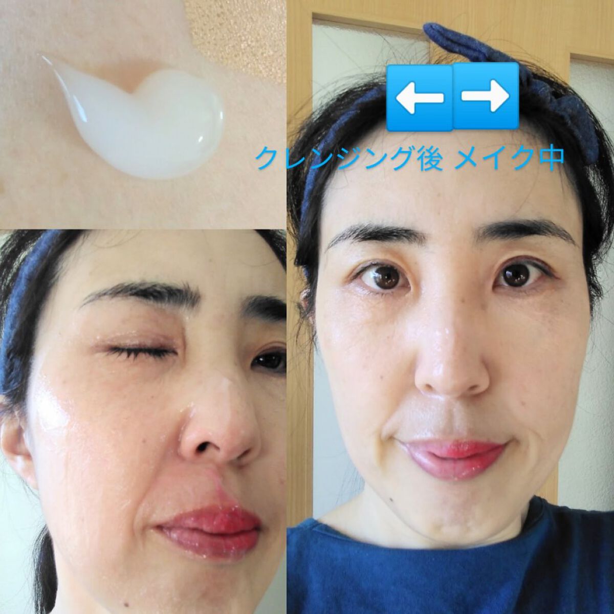 ゲルクレンジング/オンリークリニック/クレンジングジェルを使ったクチコミ(3枚目)