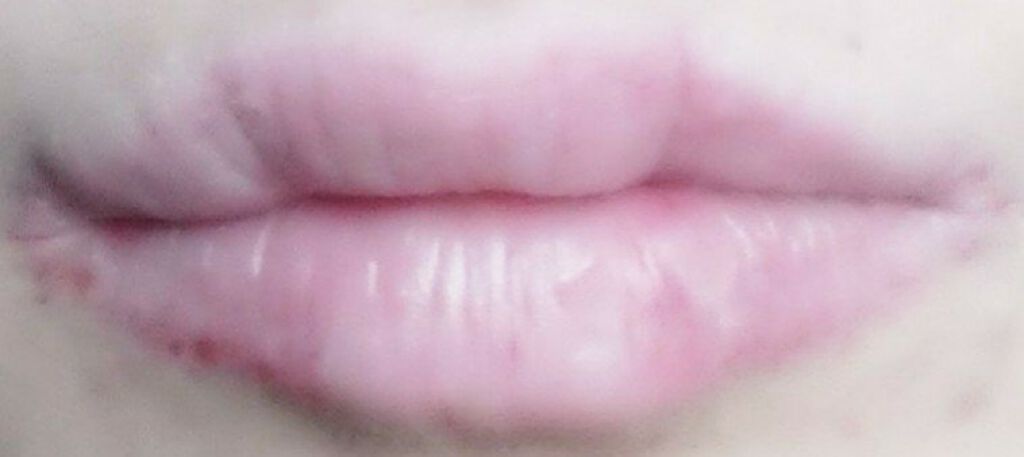 ドトムリッププラスプランパー/keybo/リッププランパーを使ったクチコミ(3枚目)