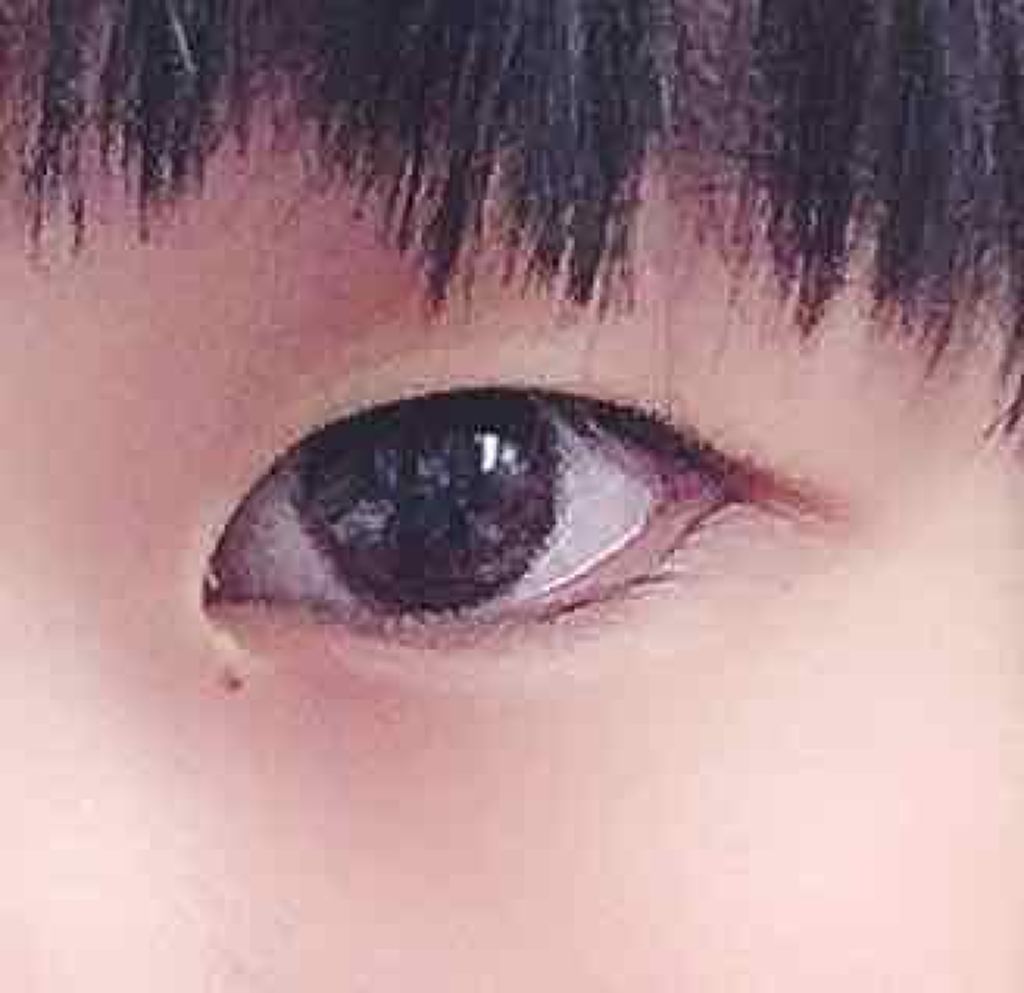 ダブルアイリッド/DAISO/二重まぶた用アイテムを使ったクチコミ(2枚目)