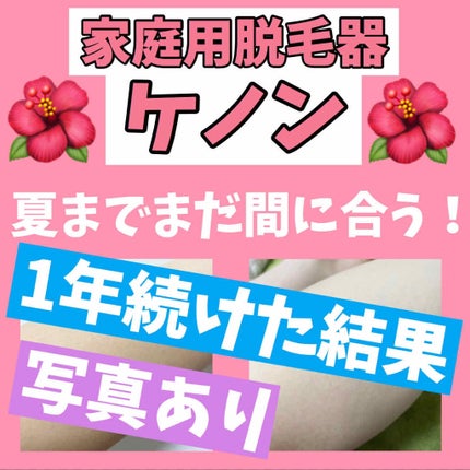 光美容器KE-NON(ケノン)/エムテック/家庭用脱毛器を使ったクチコミ(1枚目)
