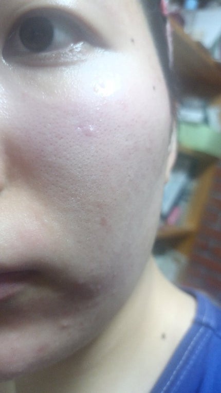 ブライトニングケア ローション M(医薬部外品)/アクアレーベル/化粧水を使ったクチコミ(5枚目)