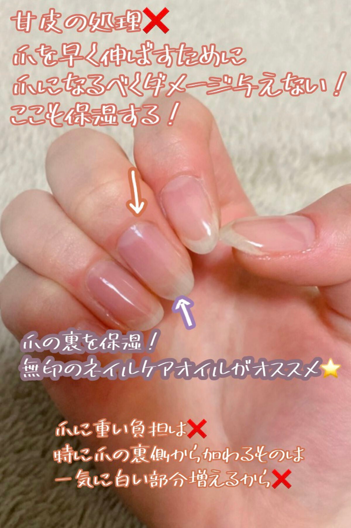 える on LIPS 「一ヶ月でハイポキニウム育成!ブサ爪だった私が一ヶ月頑張ったらこ..」(2枚目)