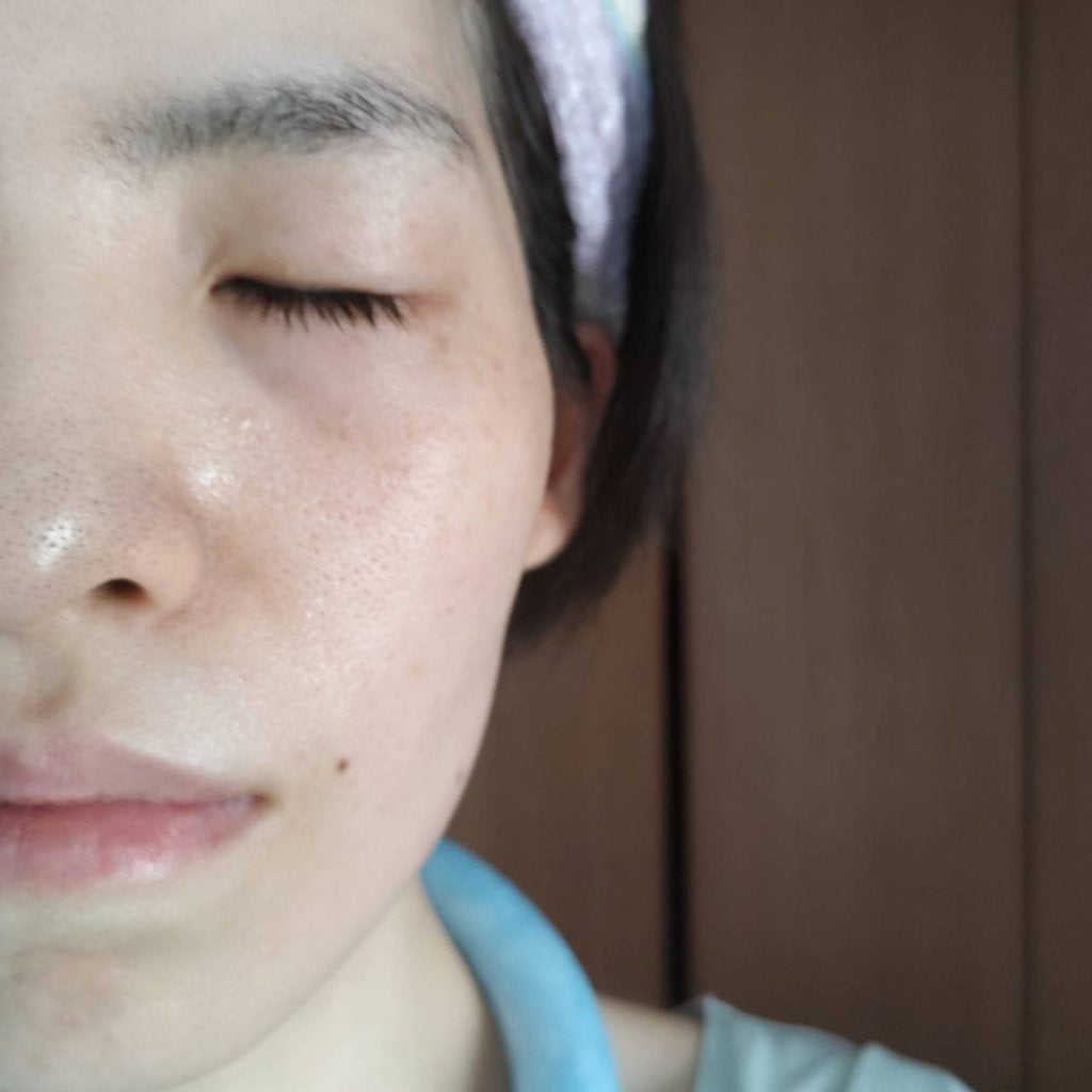 レッドブレミッシュ クリアスージングクリーム/Dr.G/フェイスクリームを使ったクチコミ(5枚目)