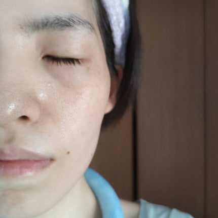 レッドブレミッシュ クリアスージングクリーム/Dr.G/フェイスクリームを使ったクチコミ(5枚目)