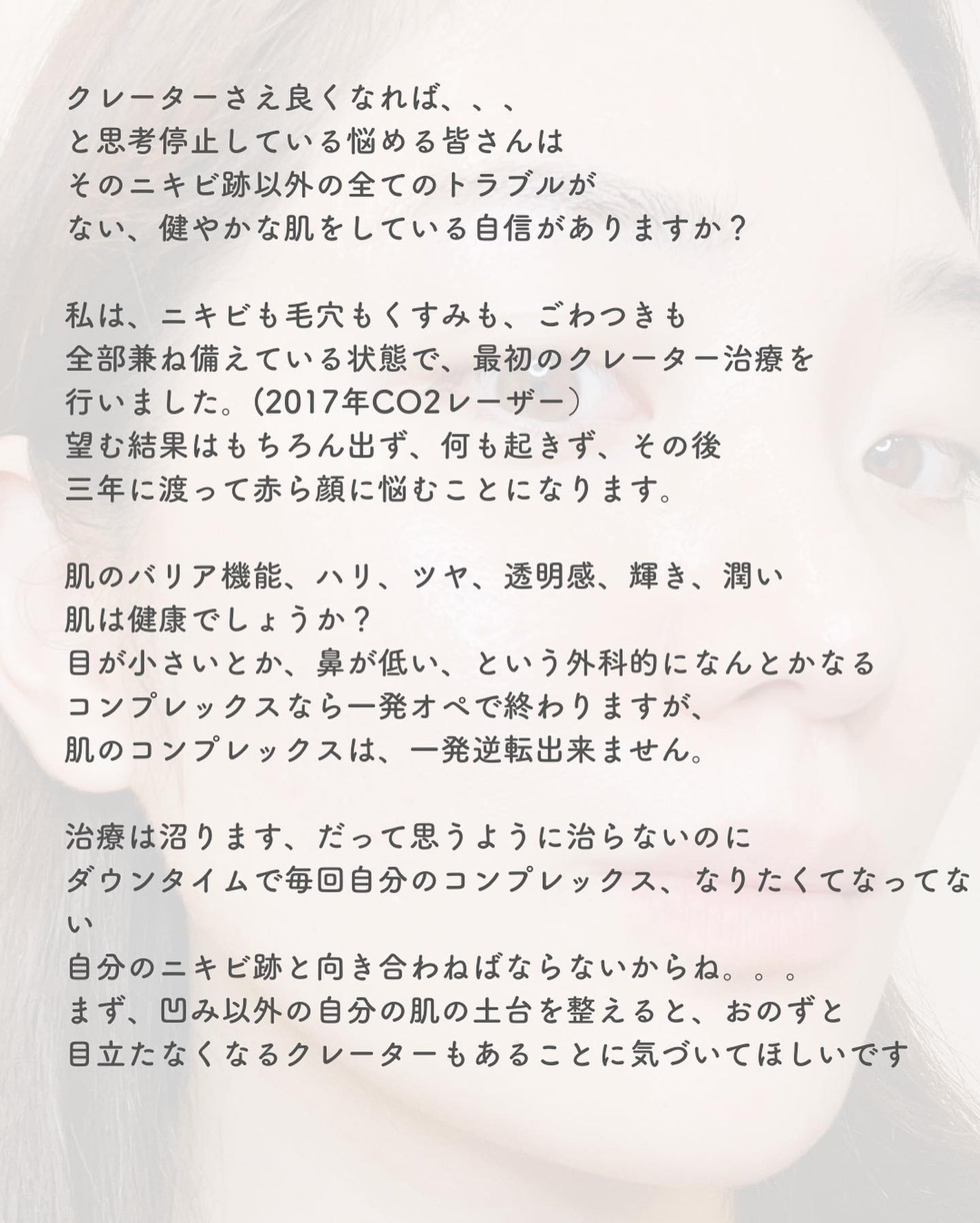 おゆみ|ニキビ・ニキビ跡ケア on LIPS 「【クレーター治療の基本のキ】こんばんは、おゆみです✨クレーター..」(10枚目)