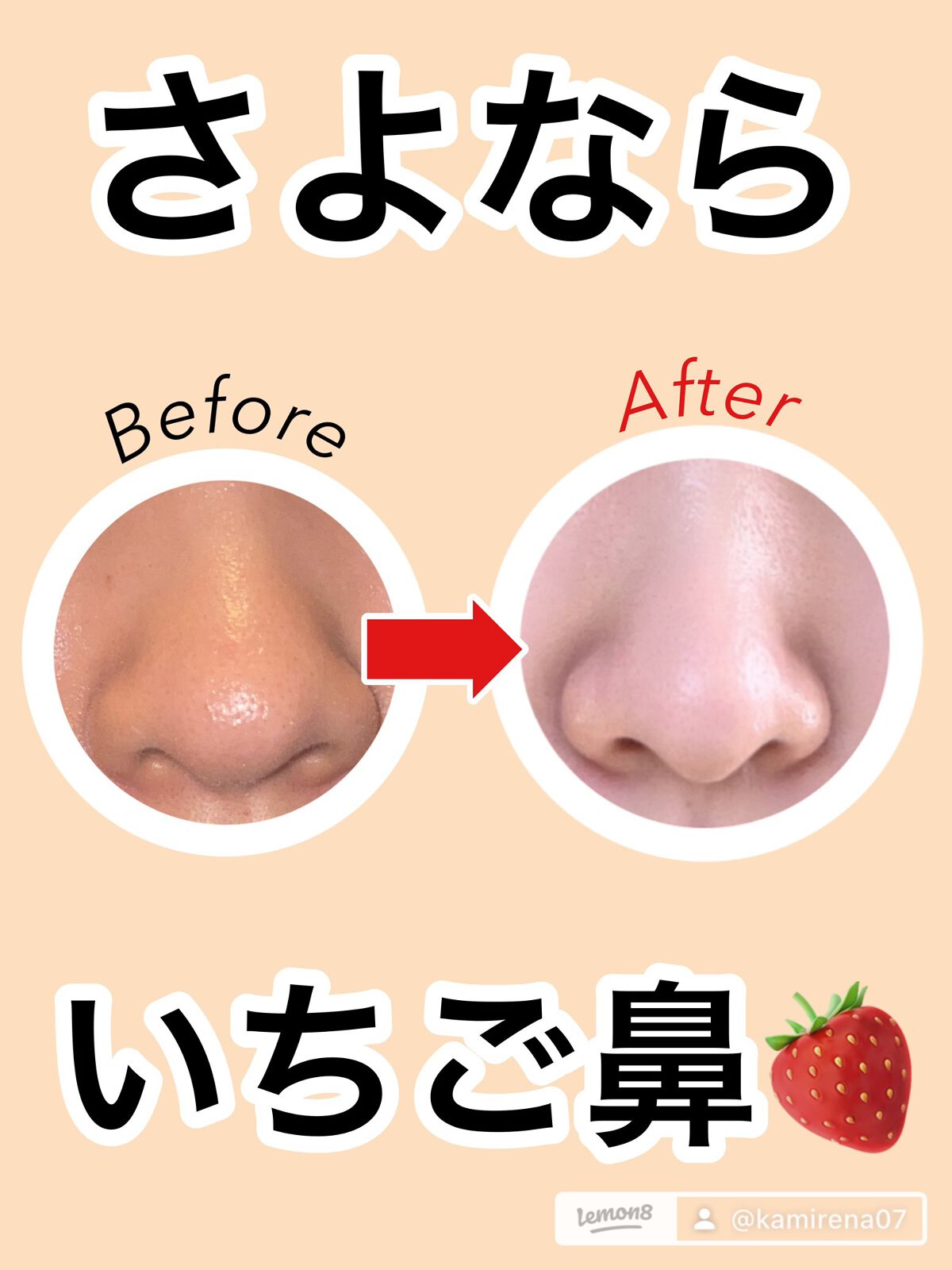 スチーマー ナノケア EH-SA35/Panasonic/美顔器・マッサージを使ったクチコミ(1枚目)