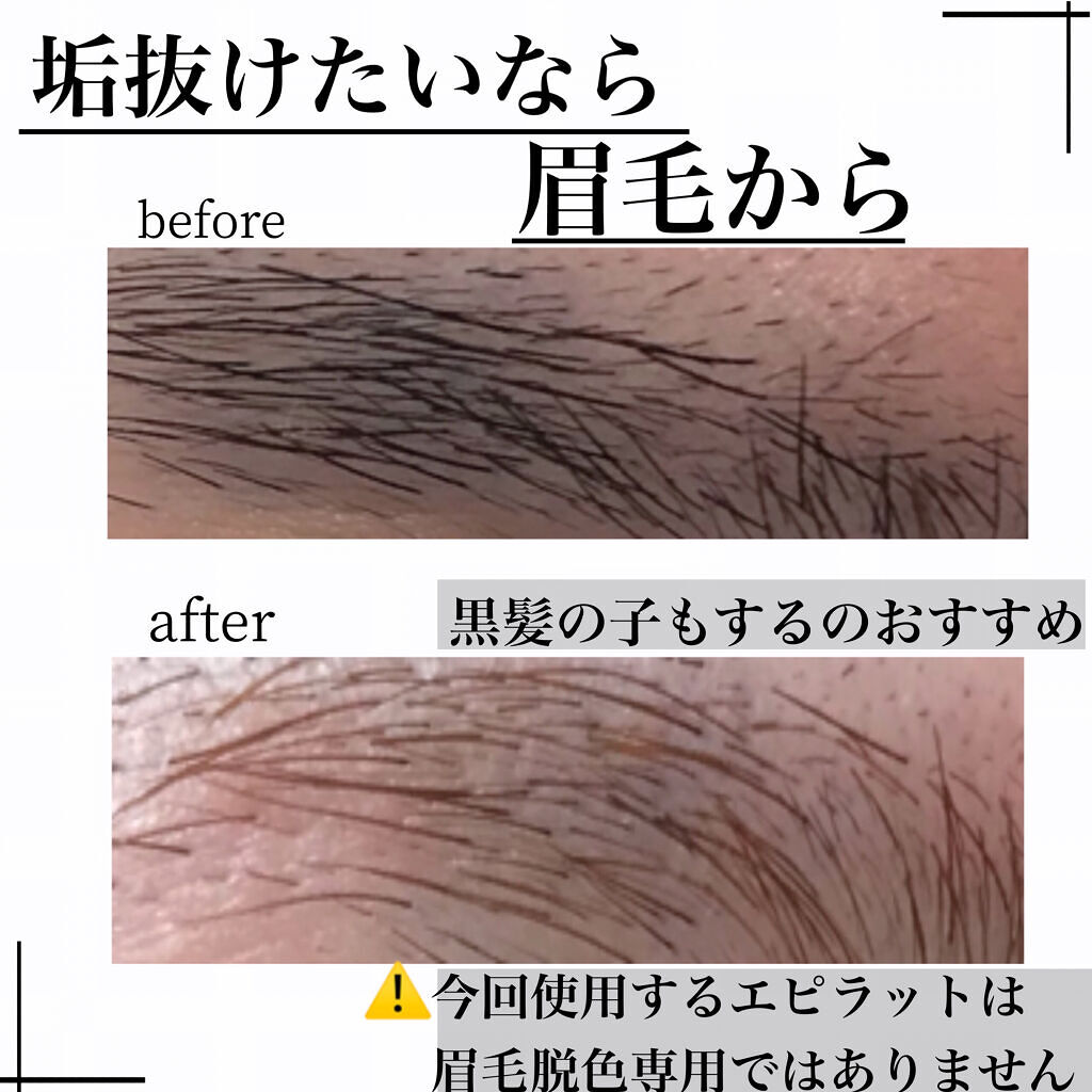 脱色クリーム 敏感肌用/エピラット/ムダ毛ケアを使ったクチコミ（1枚目）