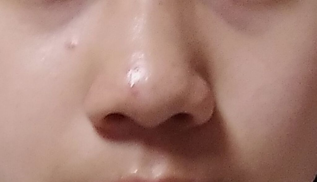 shiny_make_wt3s on LIPS 「あまり投稿しなくてすいません😭🙇♂️今日から、肌の日記をして..」(1枚目)