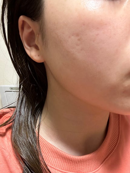 ディープブラック アクアモイスチャー シートマスク/ALFACE+/シートマスク・パックを使ったクチコミ(2枚目)