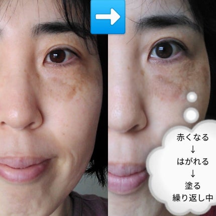 ハイドスピキュールクリーム/マークエイド/フェイスクリームを使ったクチコミ(2枚目)