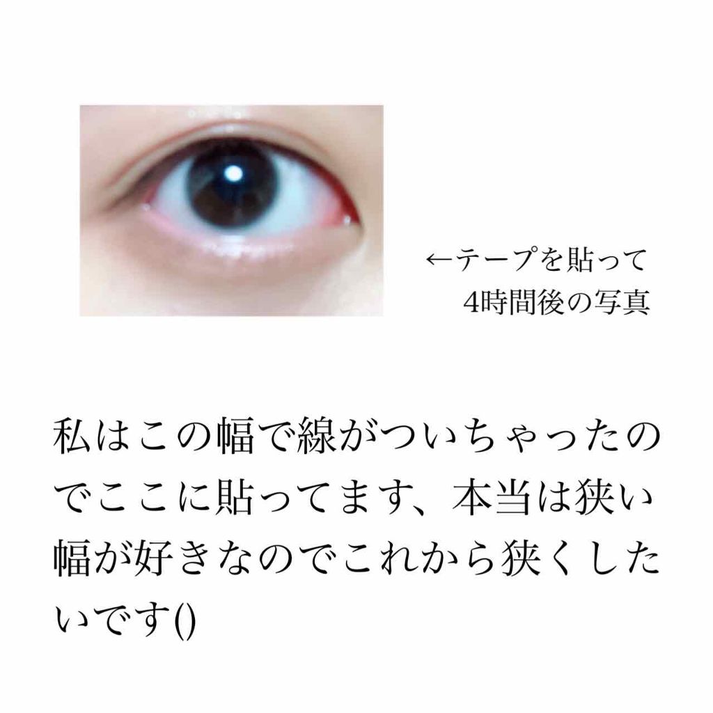 ワンダーアイリッドテープ Extra/D-UP/二重まぶた用アイテムを使ったクチコミ(2枚目)