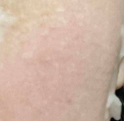 ããããBOMBãã¹ã¯/ã¯ãªã¢ã¿ãŒã³/ã·ãŒããã¹ã¯ã»ããã¯ã䜿ã£ãã¯ãã³ãïŒ2æç®ïŒ